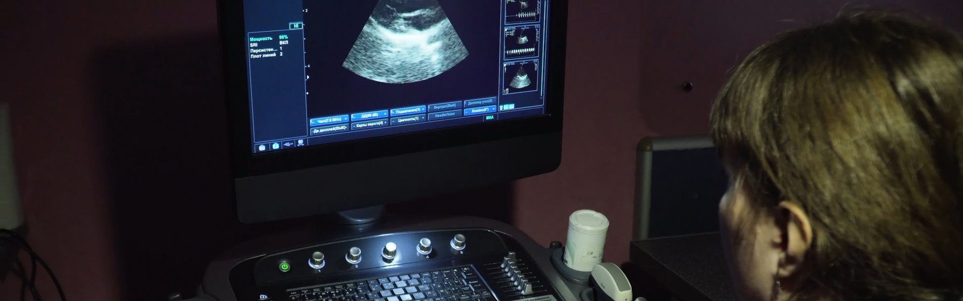 Doctor does an ultrasound examination. Ultrasound diagnostics with the image of internal organs on the screen of the monitor in a veterinary clinic. Medical ultrasound machine. Screen ultrasound